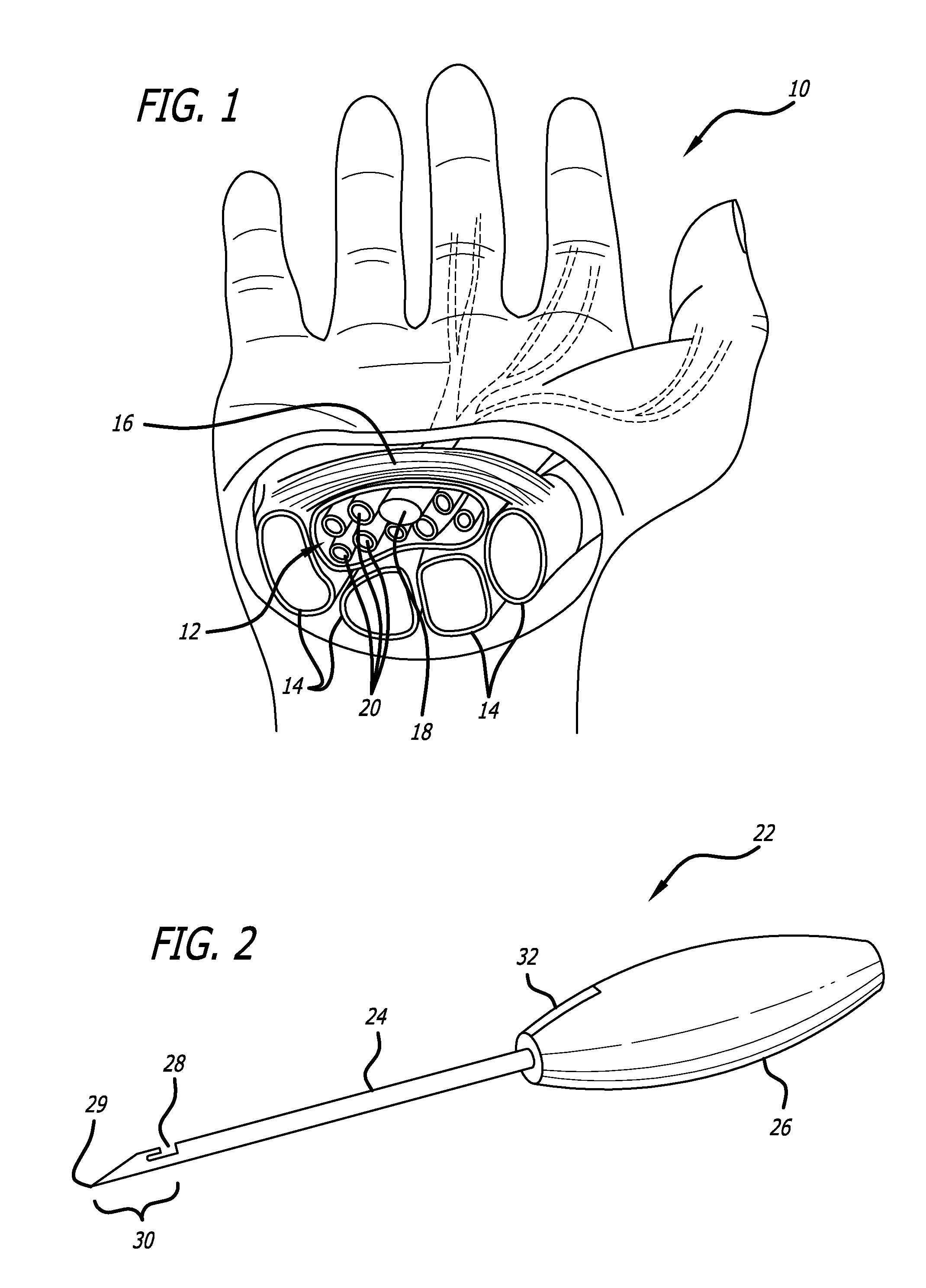 Method and apparatus for thread transection of a ligament