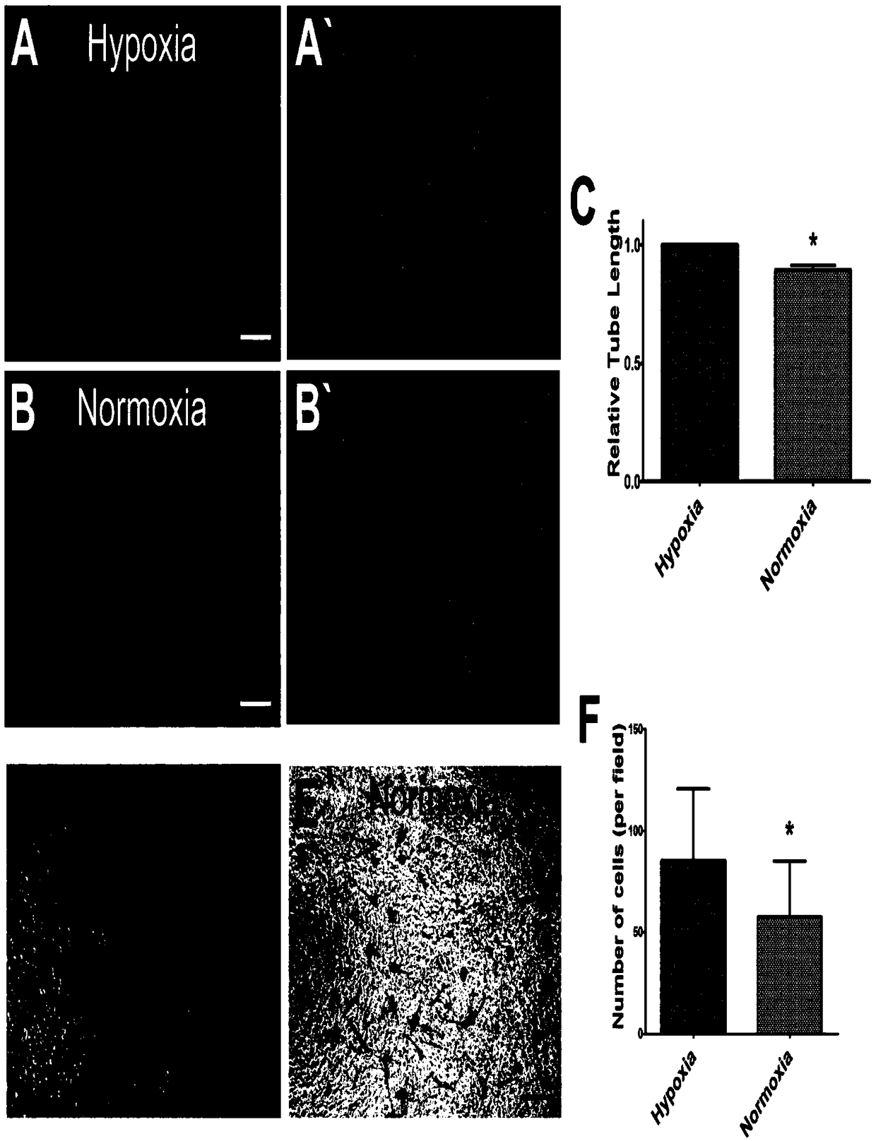 Method for ex vivo expansion of human vascular endothelial progenitor cells in low oxygen condition