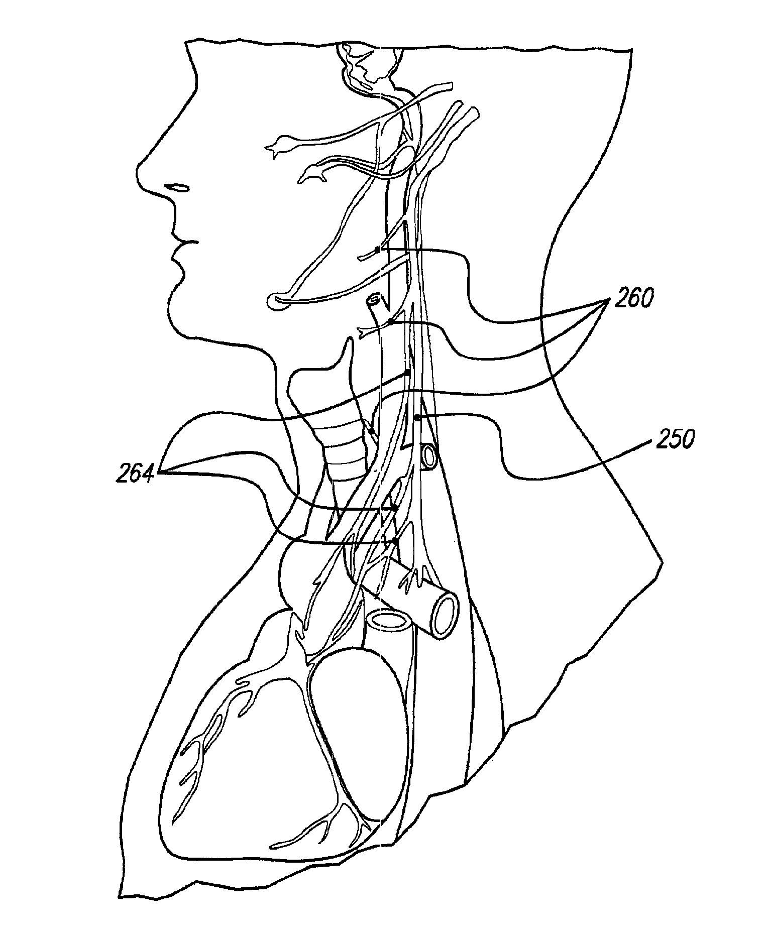 Vagus nerve stimulation via unidirectional propagation of action potentials