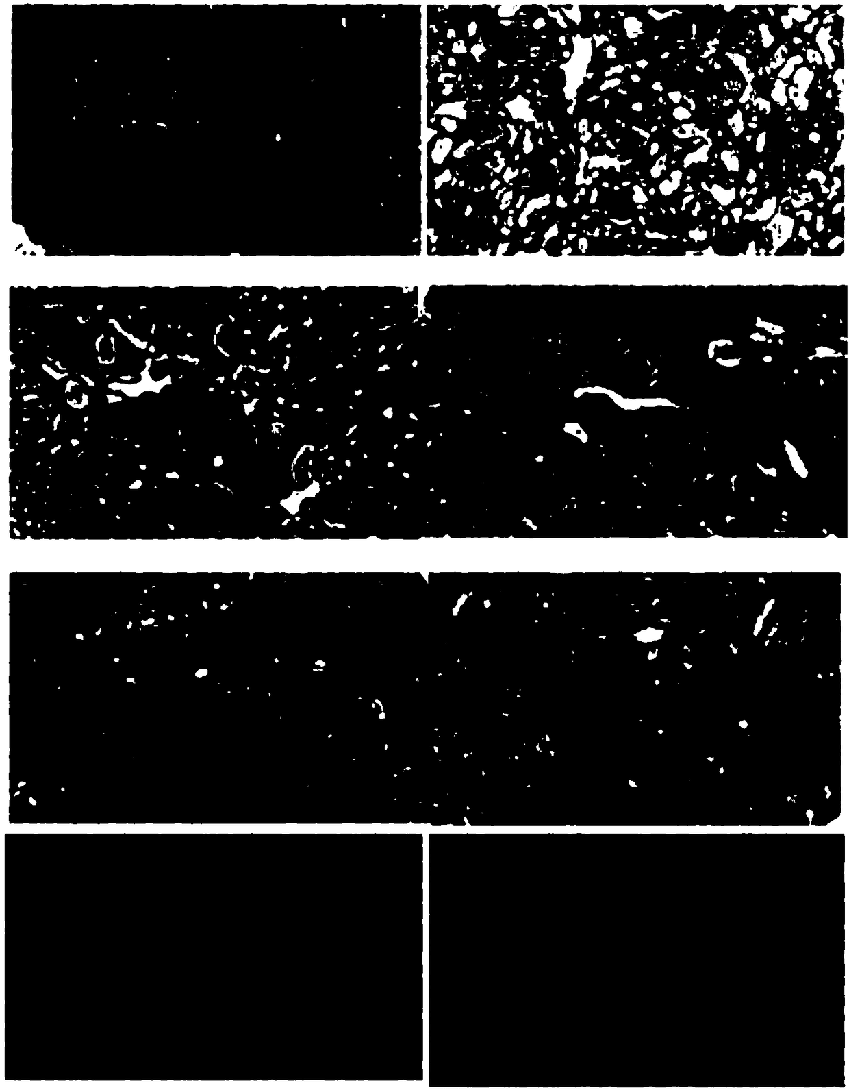 Application of phospholipid rich in DHA (Docosahexaenoic Acid) to product for improving acute kidney injury