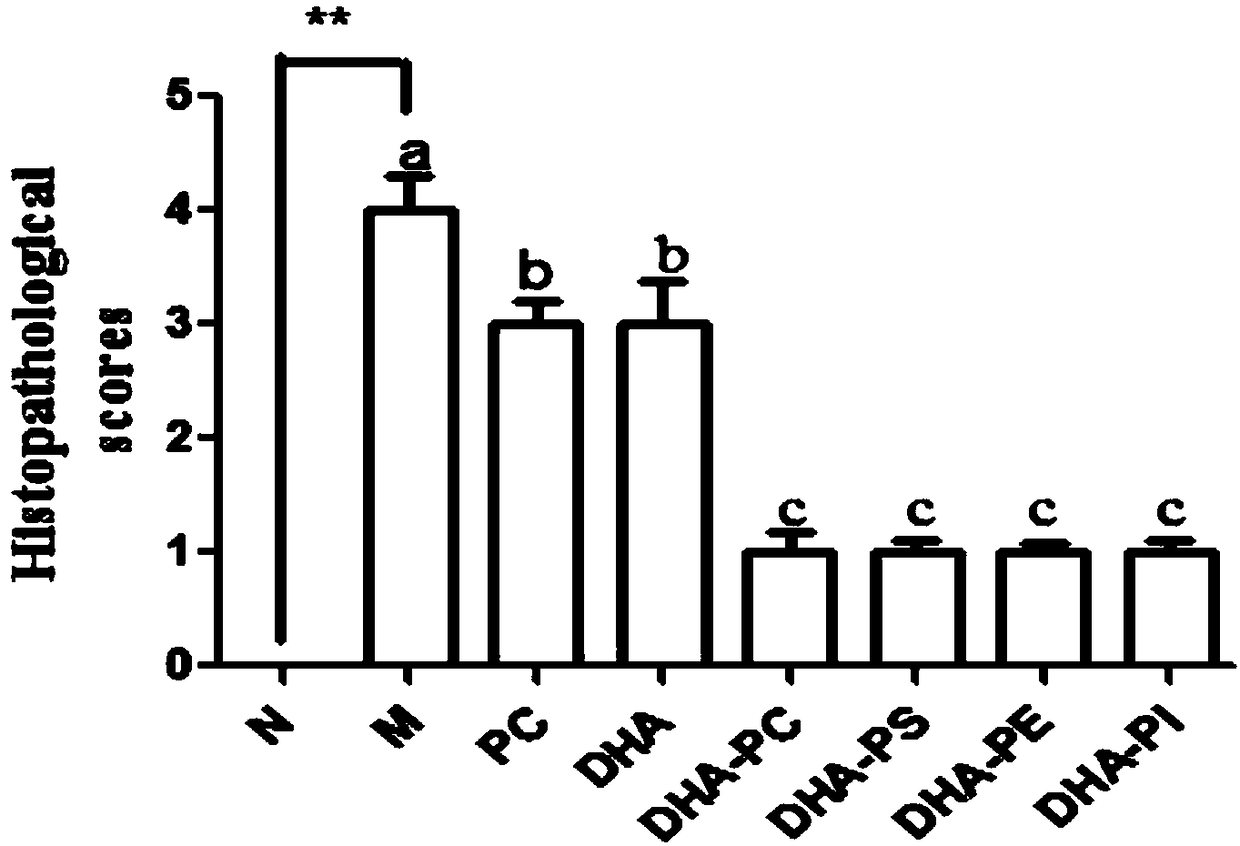 Application of phospholipid rich in DHA (Docosahexaenoic Acid) to product for improving acute kidney injury