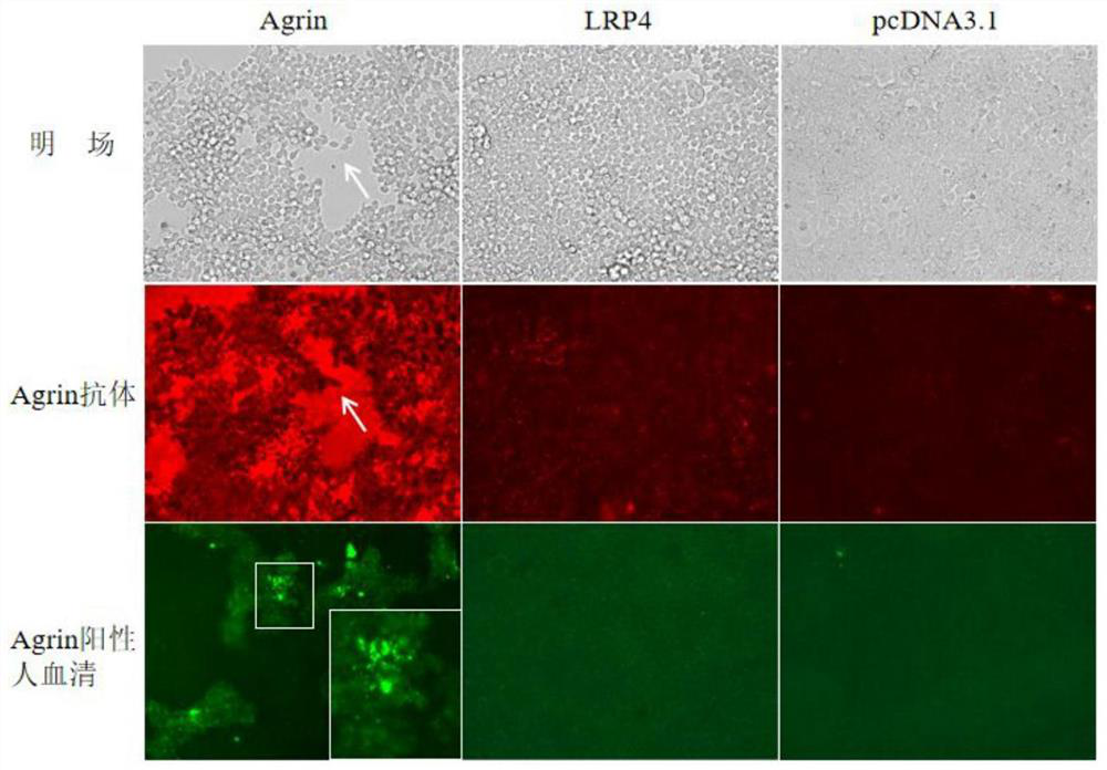 Reagent and method for improving quality of Agrin protein immunofluorescence flaking and application