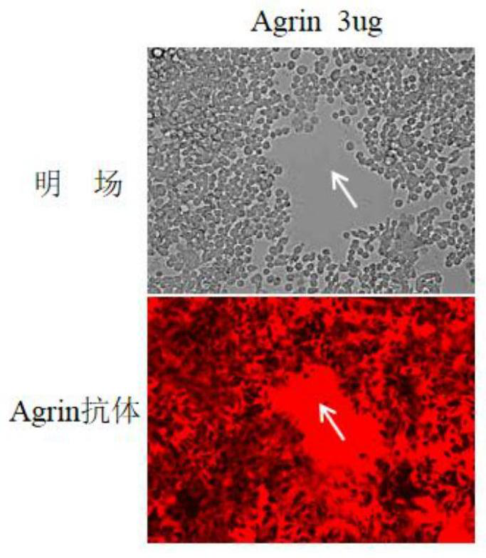 Reagent and method for improving quality of Agrin protein immunofluorescence flaking and application