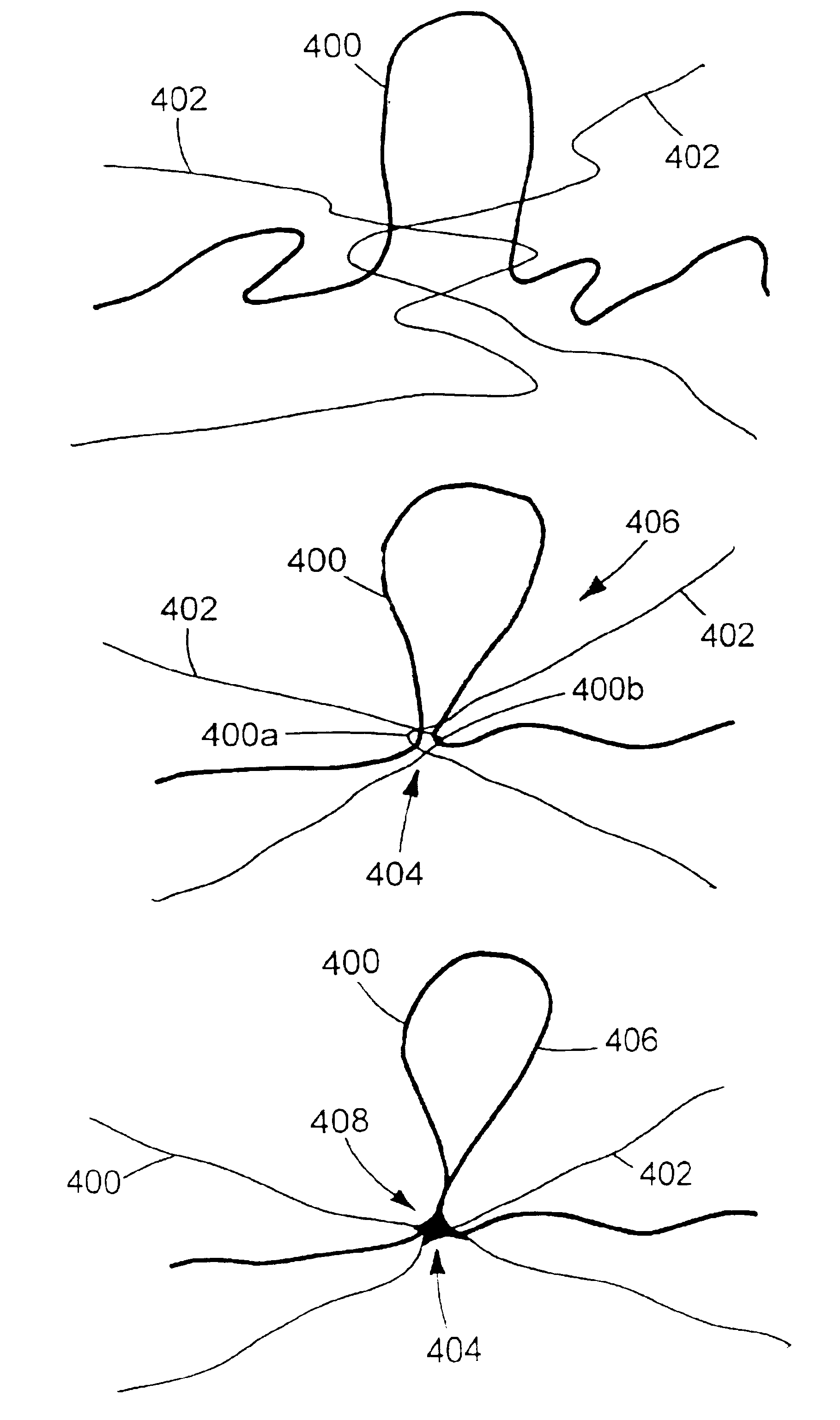 Fastener loop material, its manufacture, and products incorporating the material