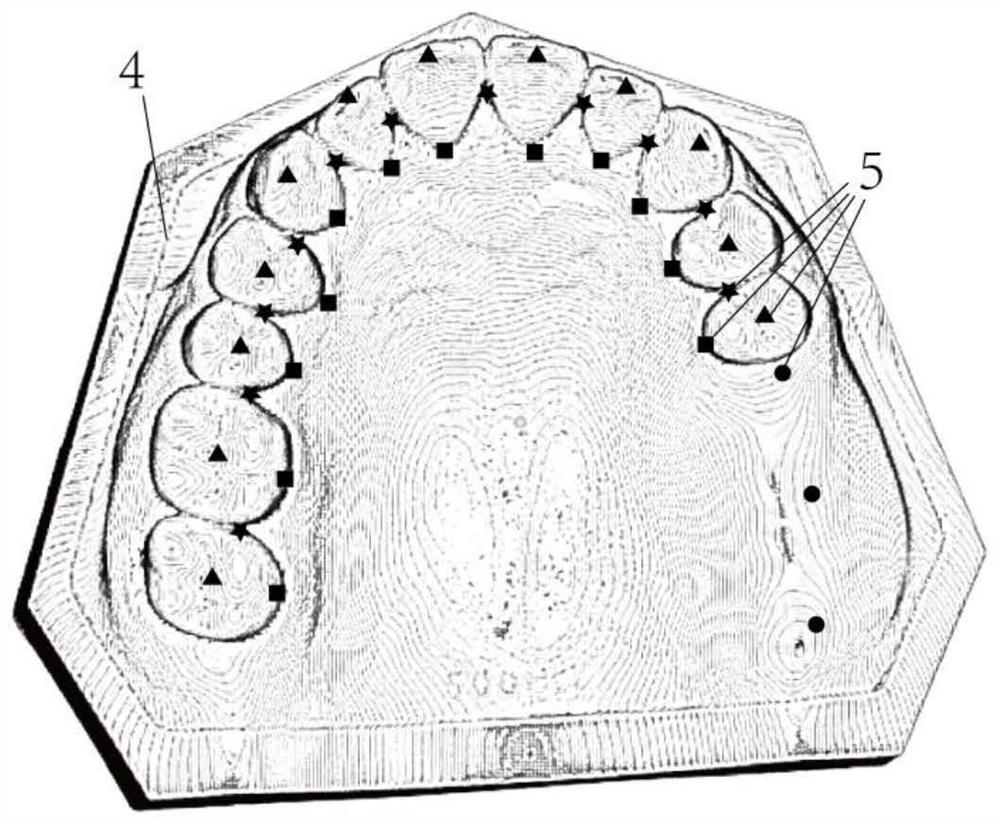 A digital design method for intraoral restorations based on big data