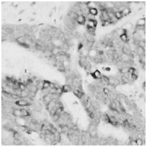 Method for detecting OGN protein expression and application of method in gastric cancer auxiliary diagnosis