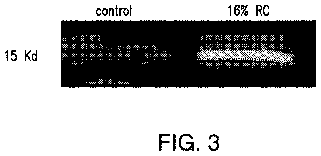 Compositions and methods for reducing the risk of radiocontrast-induced nephropathy