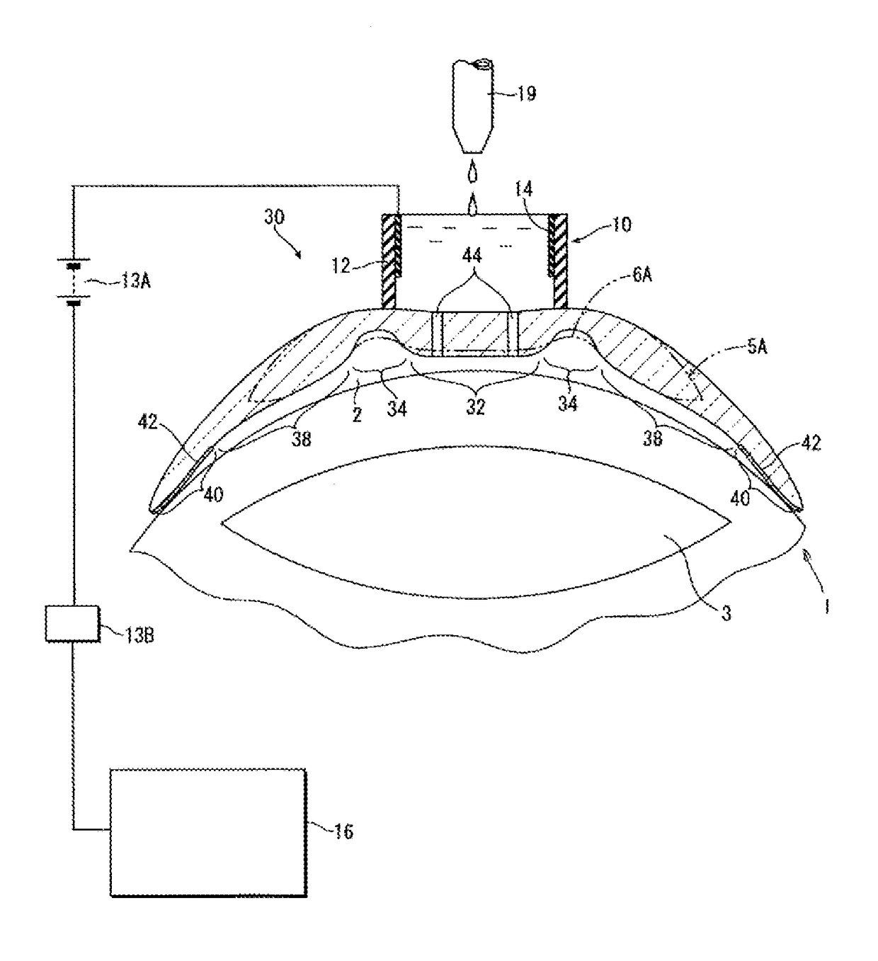 Contact lens for cornea-correction crosslinking