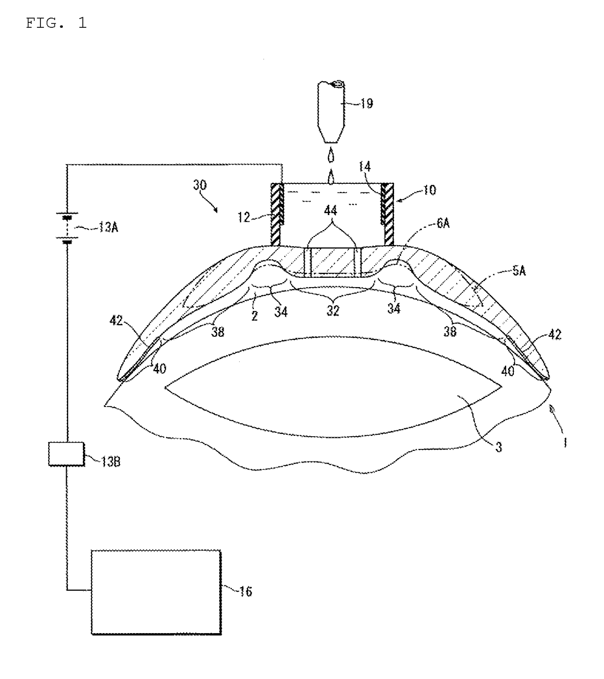 Contact lens for cornea-correction crosslinking