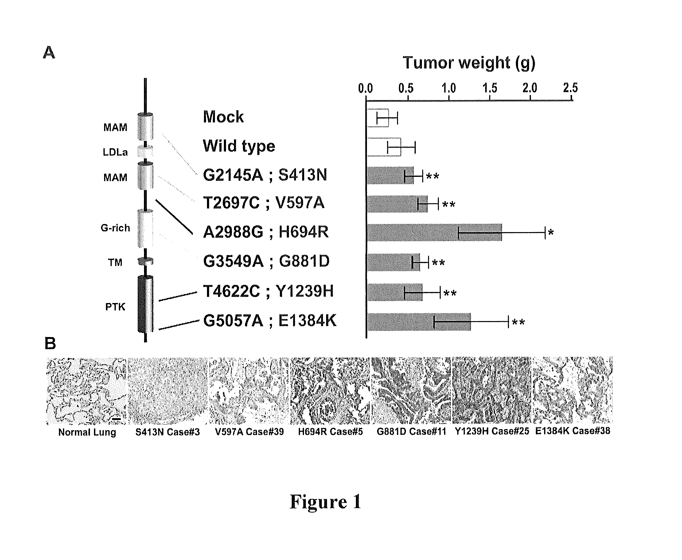 Phosphorylation and mutations of anaplastic lymphoma kinase as a diagnostic and therapeutic target in lung cancer