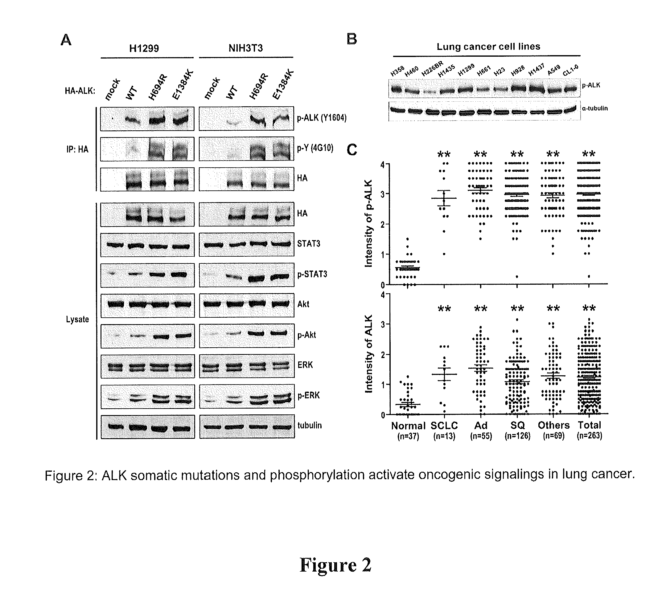 Phosphorylation and mutations of anaplastic lymphoma kinase as a diagnostic and therapeutic target in lung cancer