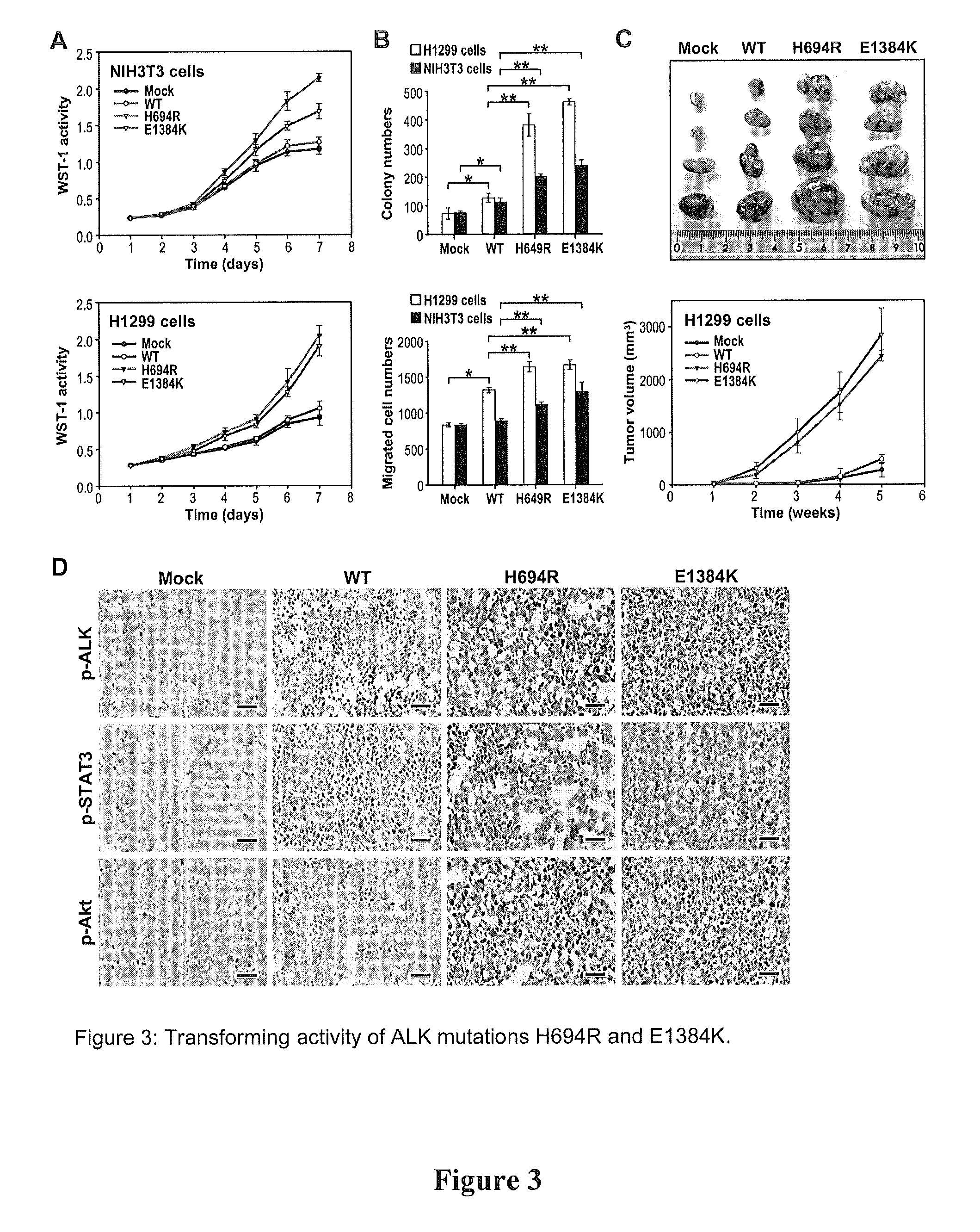 Phosphorylation and mutations of anaplastic lymphoma kinase as a diagnostic and therapeutic target in lung cancer