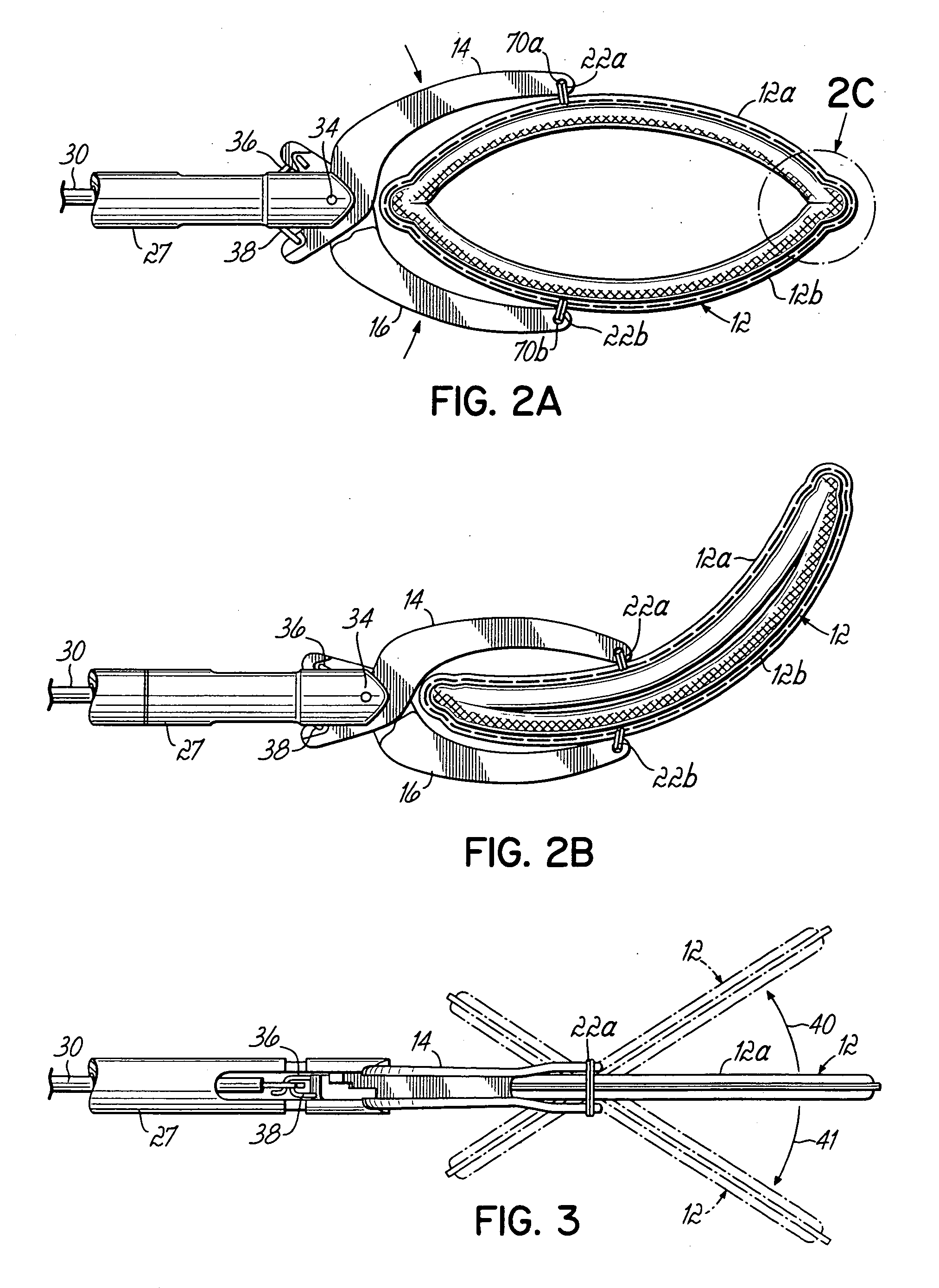 Apparatus and methods for occluding a hollow anatomical structure