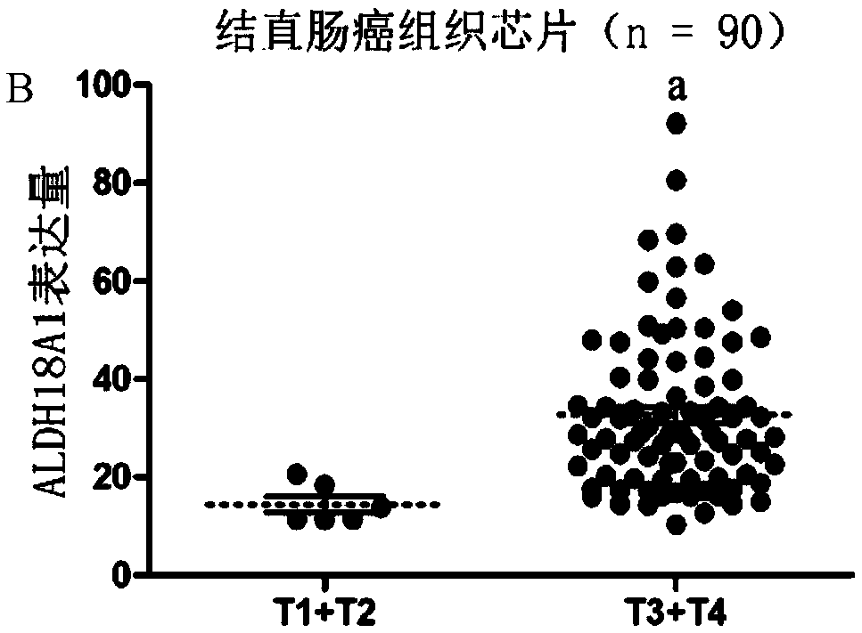 Application of ALDH18A1 in treatment and diagnosis of colorectal cancer