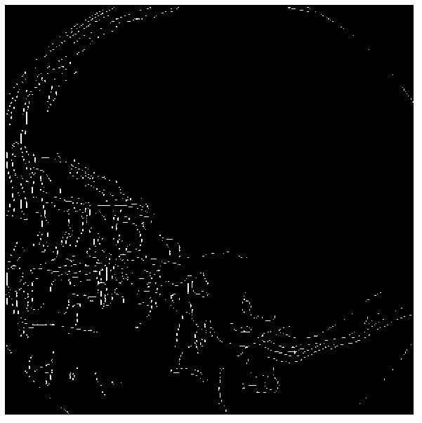 Digital image registration method, digital image registration device, digital subtraction image rectification method and digital subtraction image rectification equipment