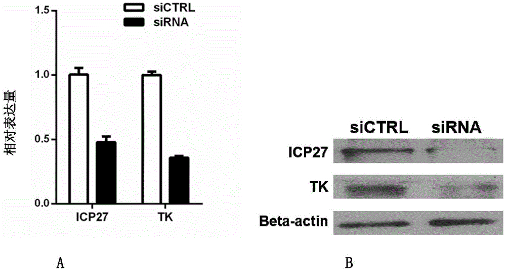 Antiviral double-stranded RNA and application of temperature-sensitive type gel prepared by same in treating and preventing HSV-1 caused diseases