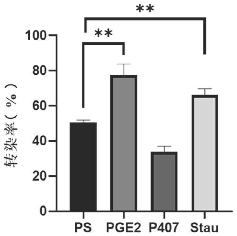 A method for lentivirus transfection of immune cells