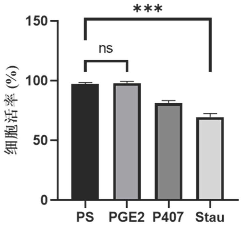 A method for lentivirus transfection of immune cells