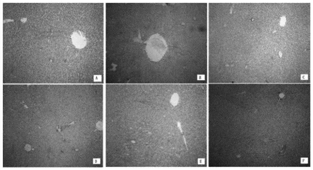 Application of rhodiola rosea oligomer procyanidine in preparing medicine for treating atherosclerosis disease