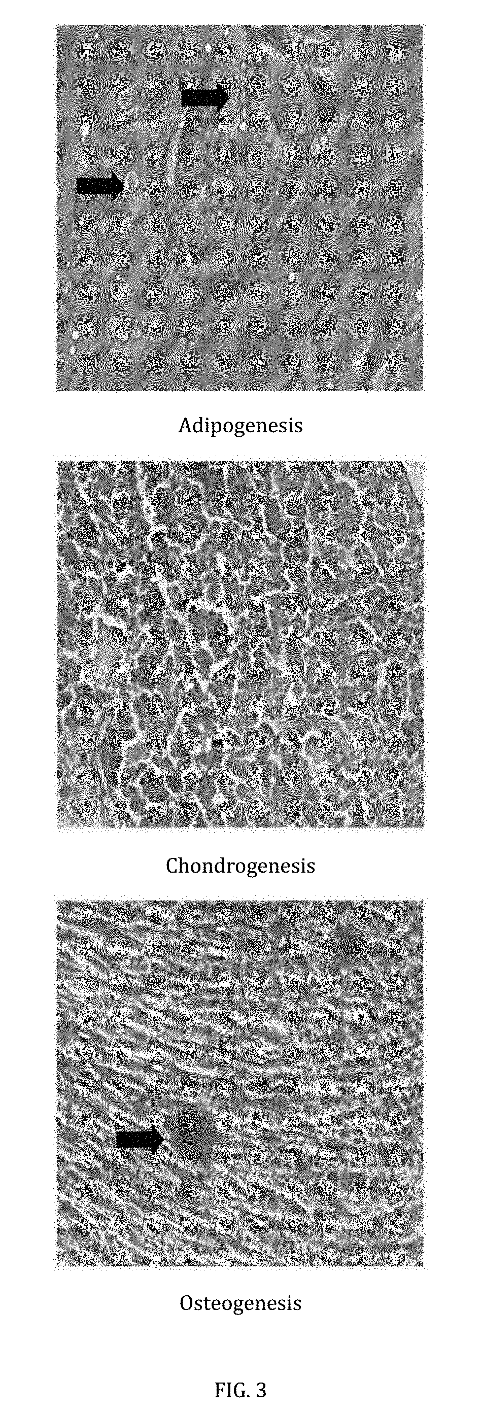 Cell-based composition and use thereof for treatment of acute stroke