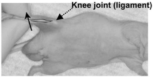 Method for preparing in-situ and pulmonary metastasis tumor model through intra-tibial injection