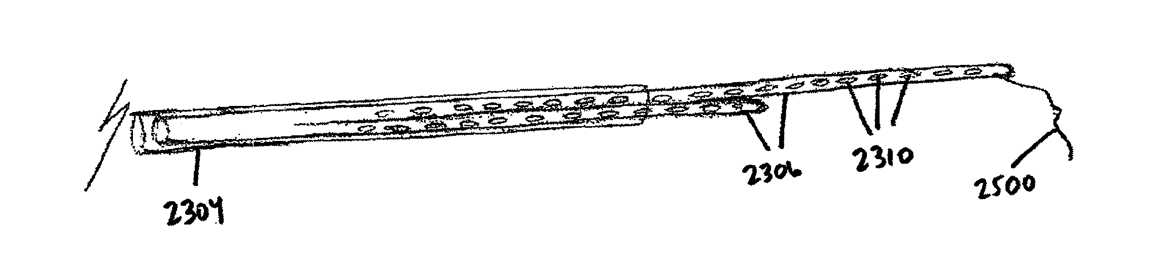 Devices, systems, and methods for myocardial infarct border zone reinforcement