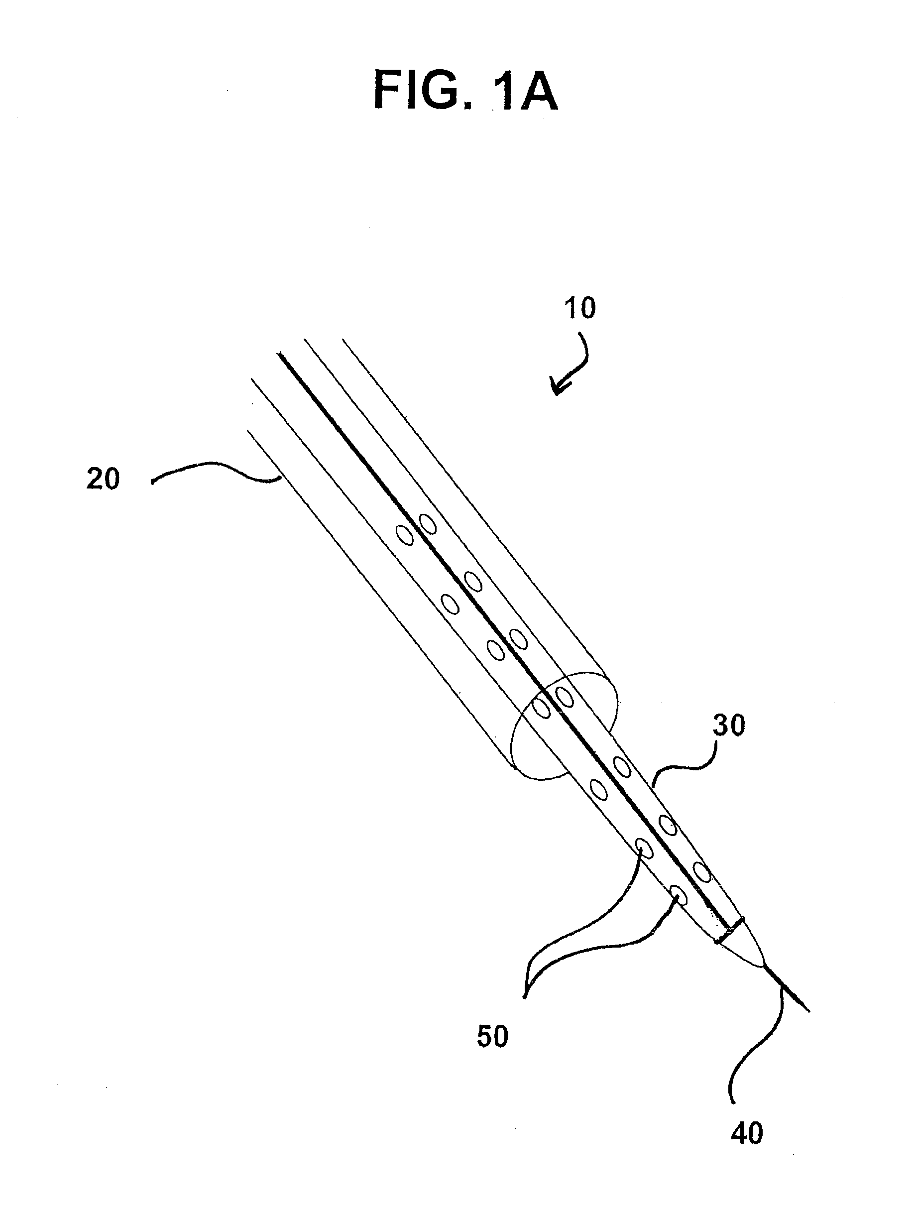 Devices, systems, and methods for myocardial infarct border zone reinforcement