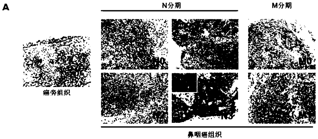 Flotillin-2 as a target for screening drugs that inhibit the metastasis of nasopharyngeal carcinoma and its application