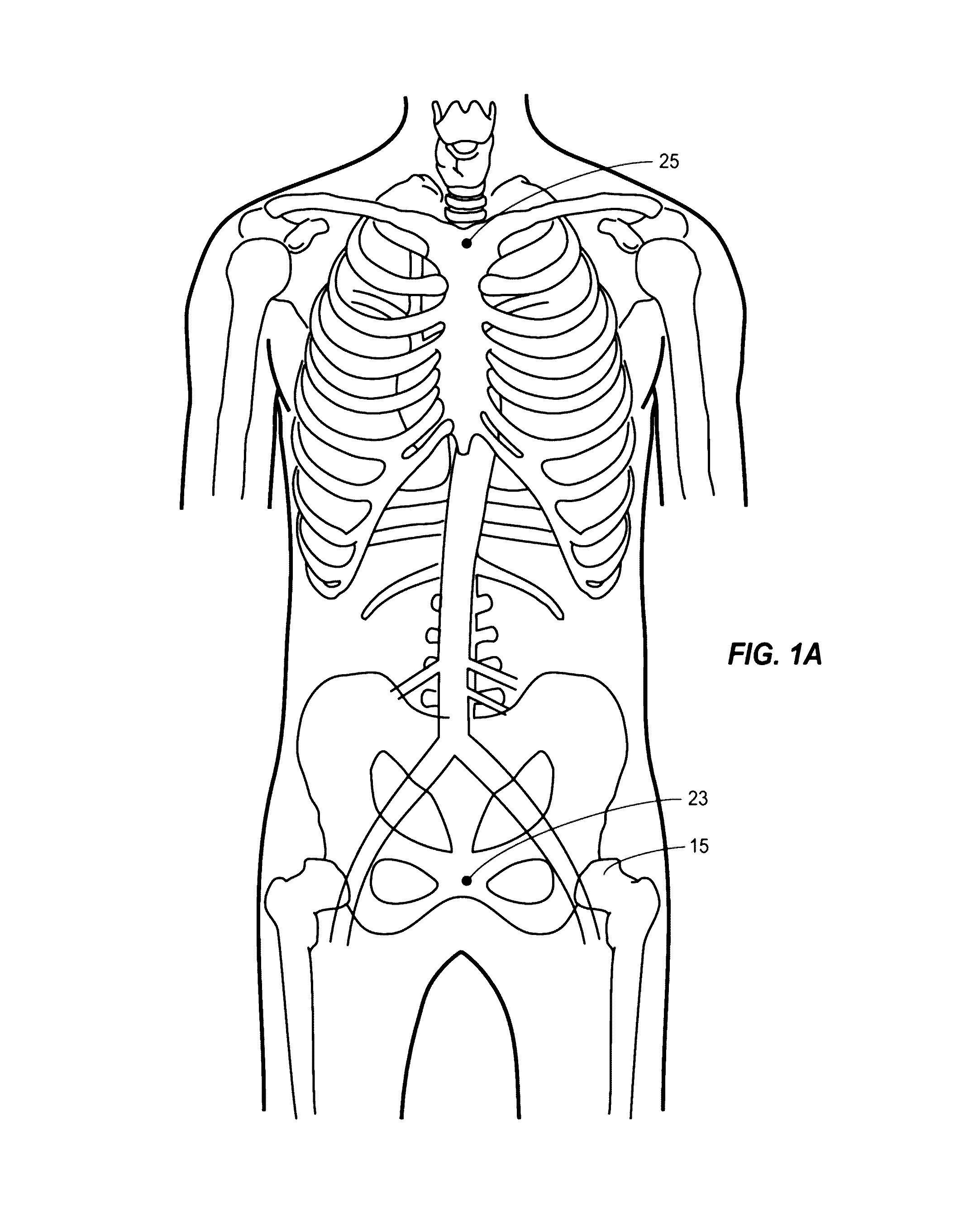 Fluoroscopy-independent balloon guided occlusion catheter and methods