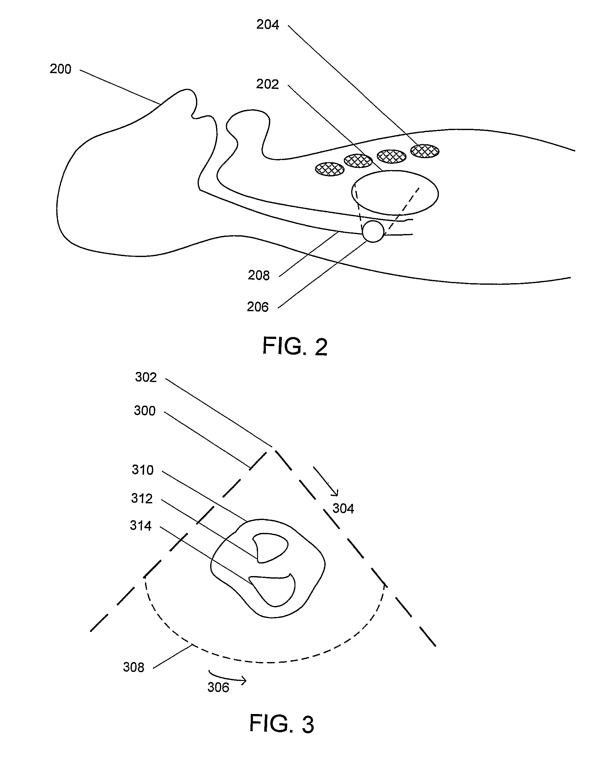 Medical training method and apparatus