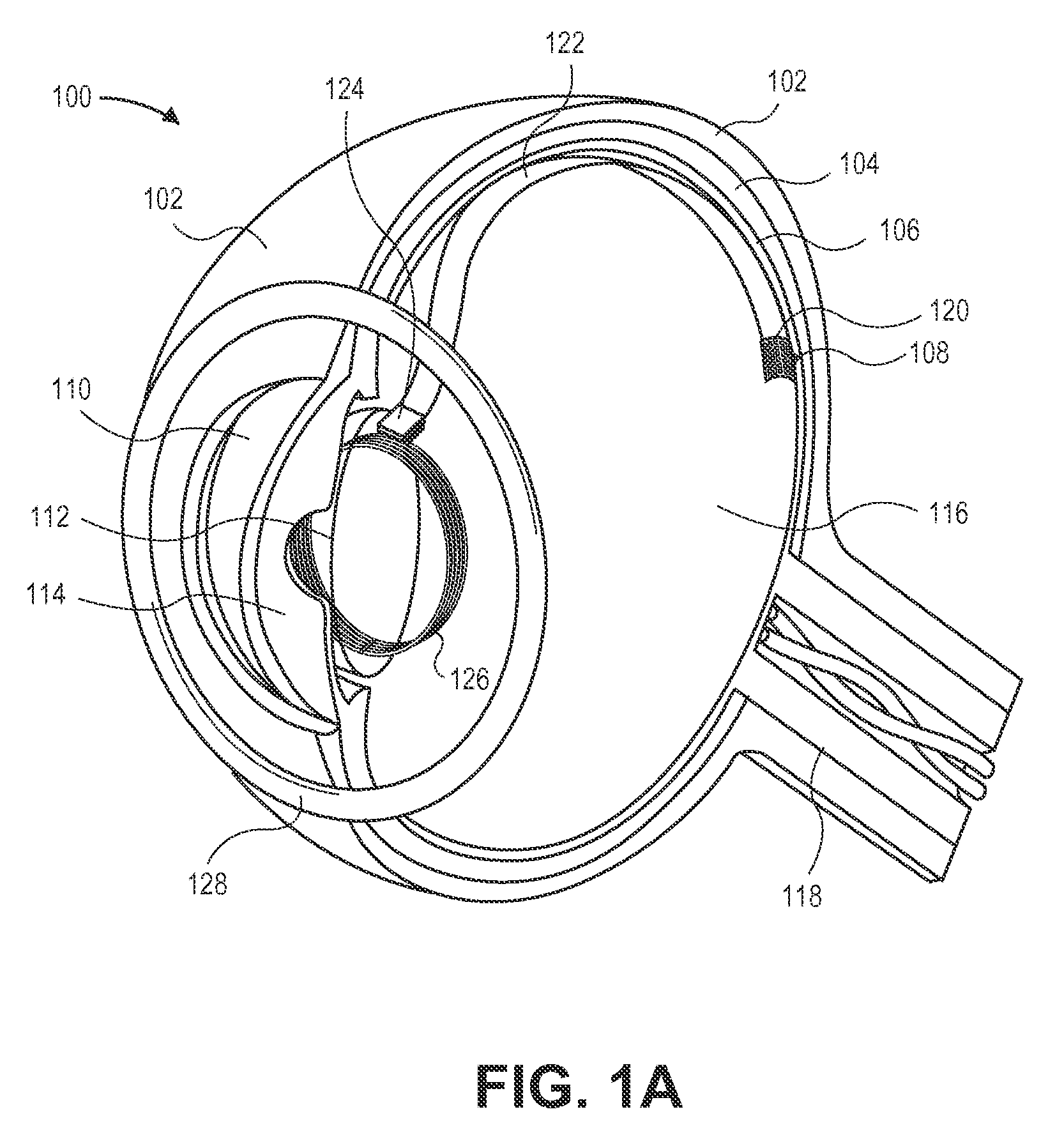 3-coil wireless power transfer system for eye implants