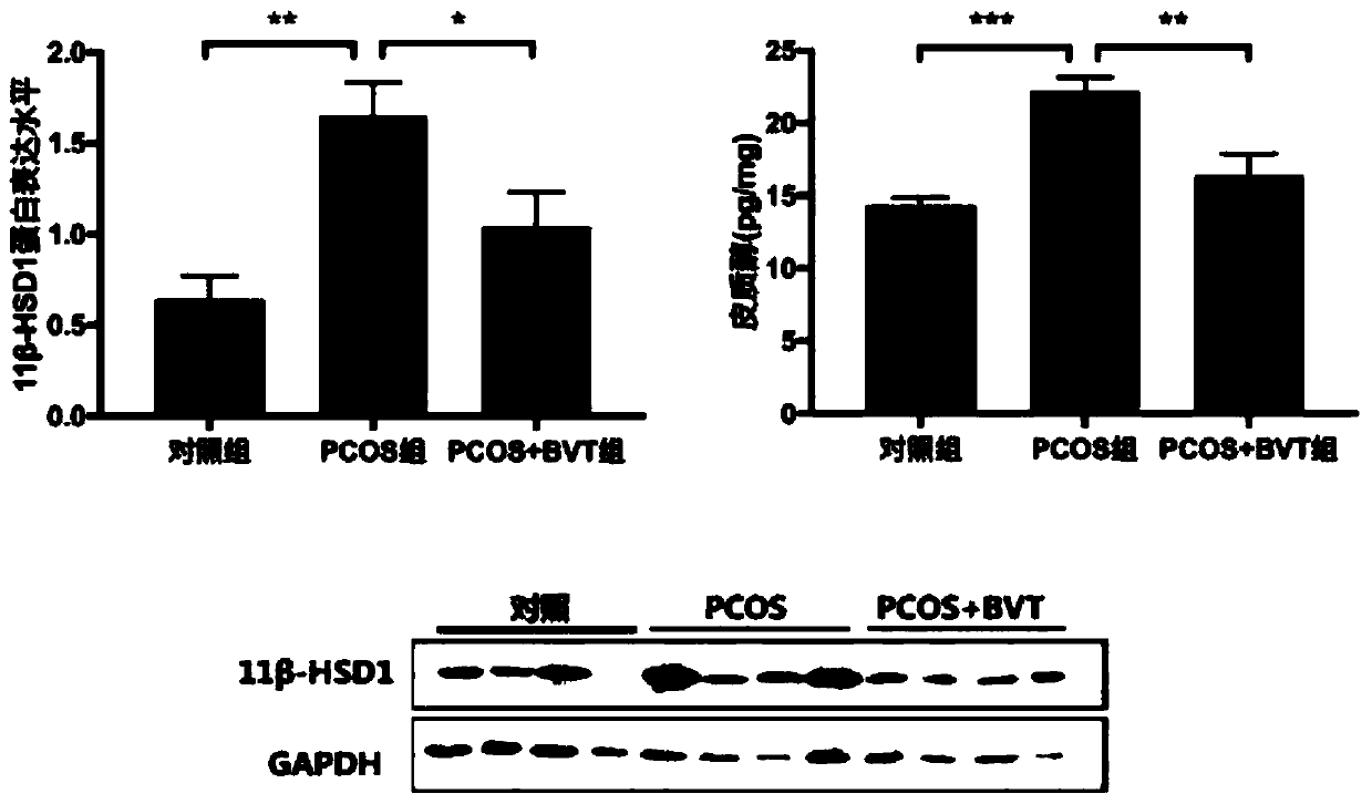 Application of 11beta-hydroxysteroid dehydrogenase 1 selective inhibitor in preparation of drug for treating polycystic ovarian syndrome