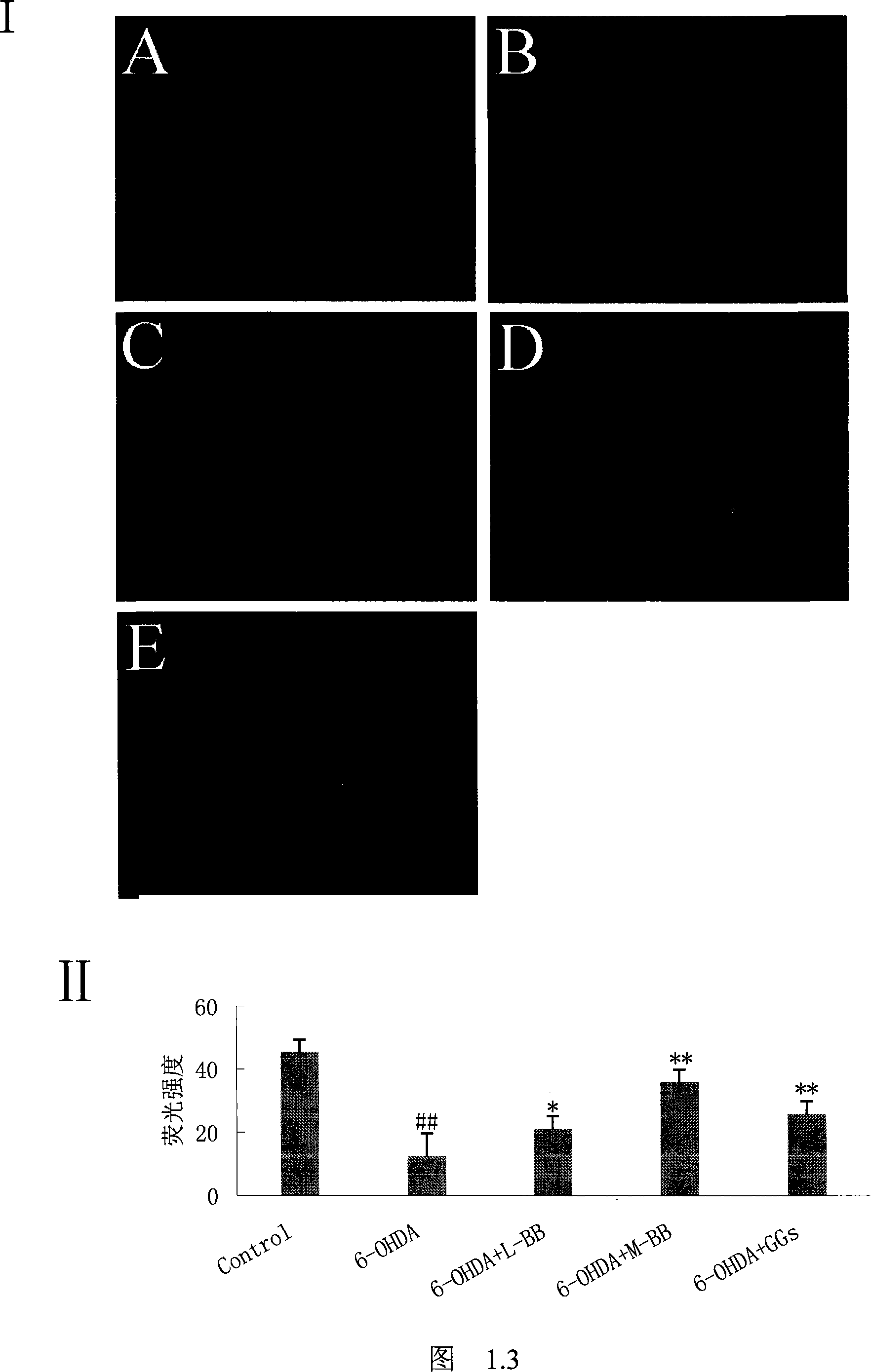 Use of bilobalide in the preparation of medicine for treating parkinsonism