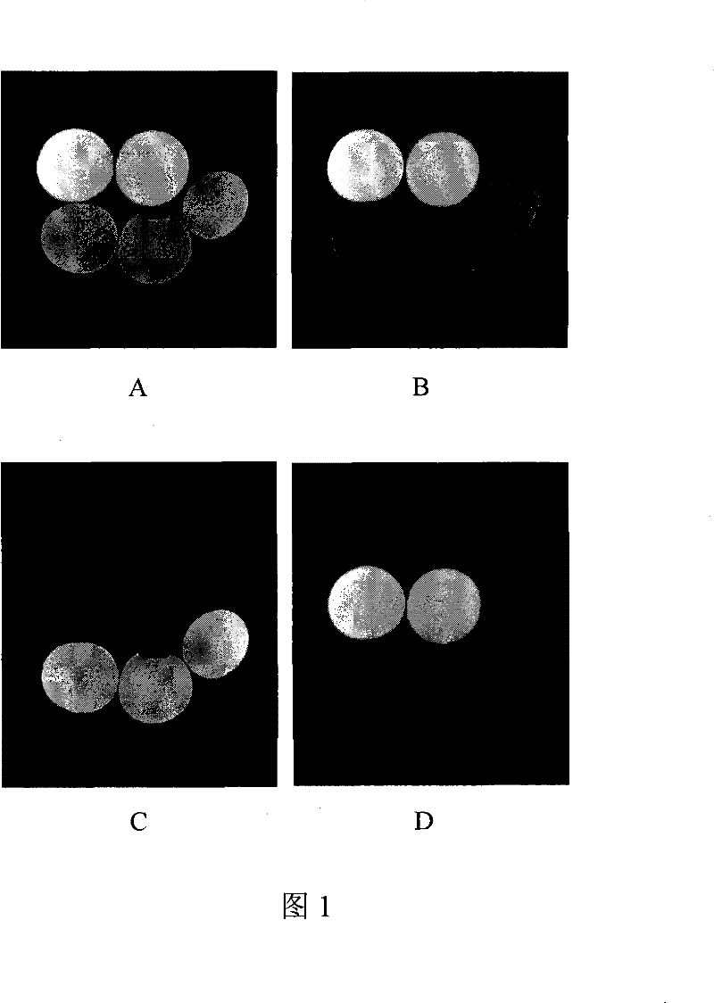 Tissue separation imaging method based on inversion recovery