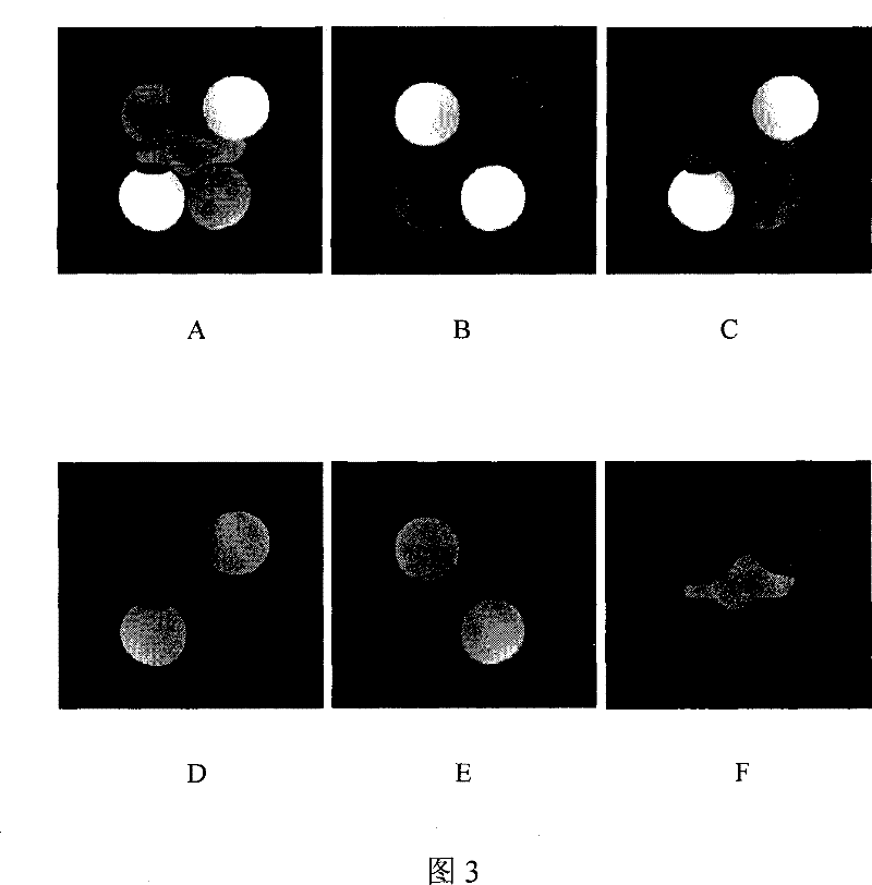 Tissue separation imaging method based on inversion recovery