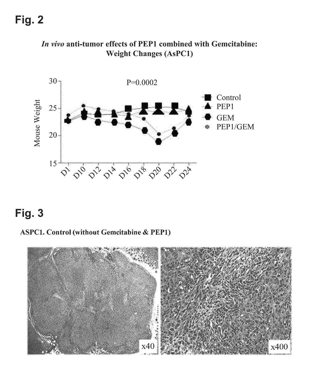 Peptide having fibrosis inhibitory activity and composition containing same