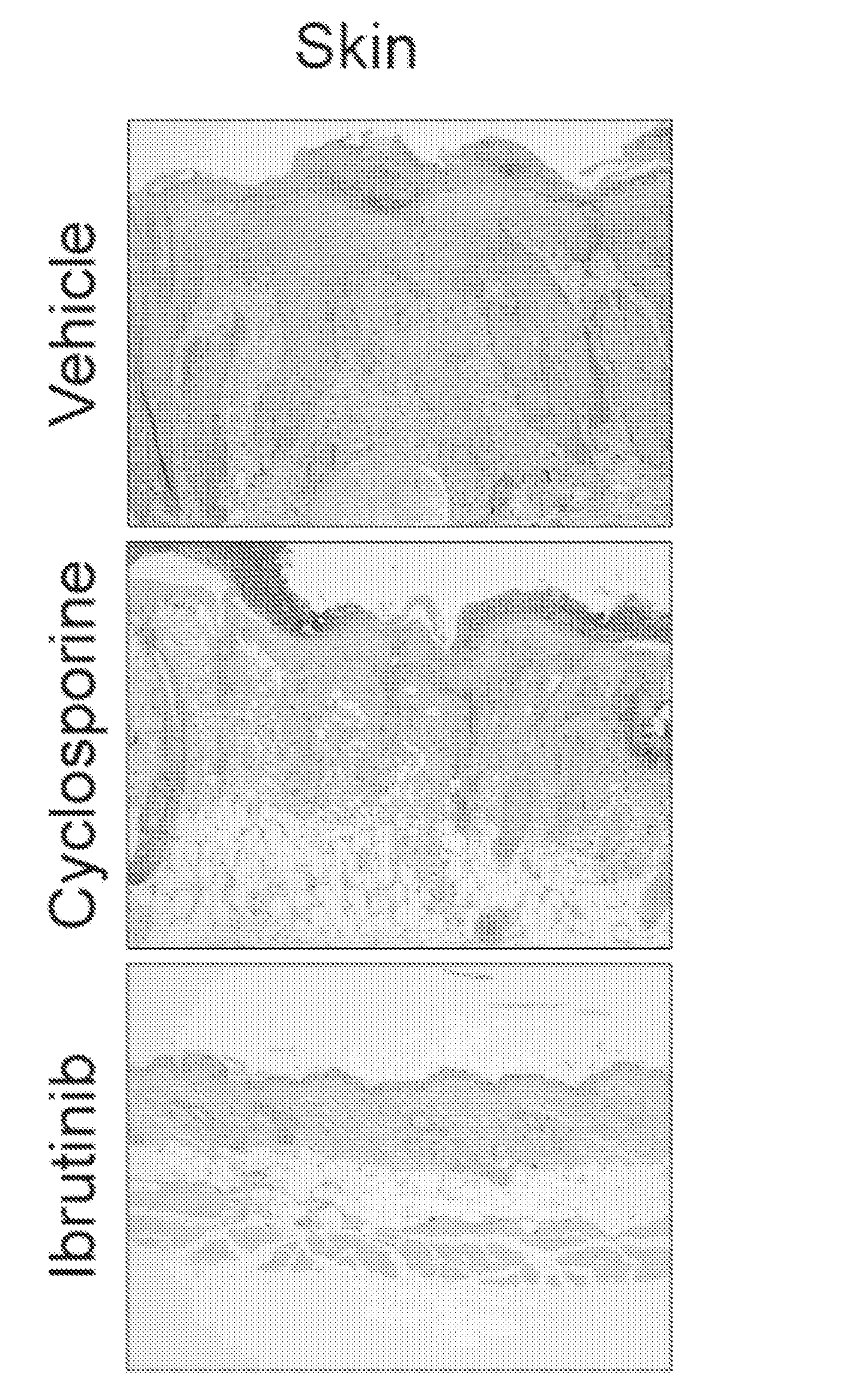 Methods of treating and preventing graft versus host disease