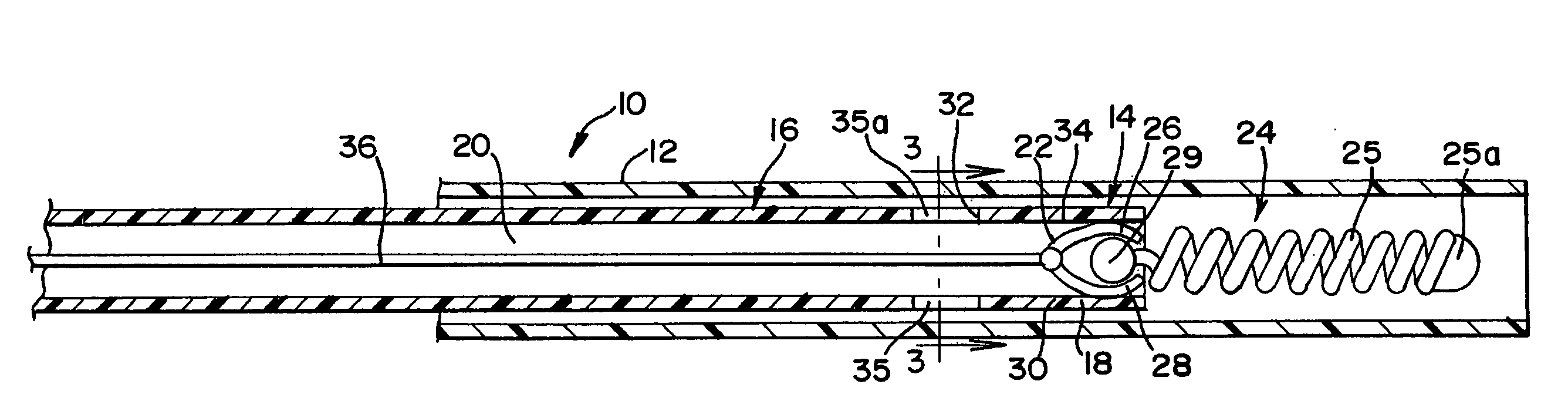 Embolic device delivery system