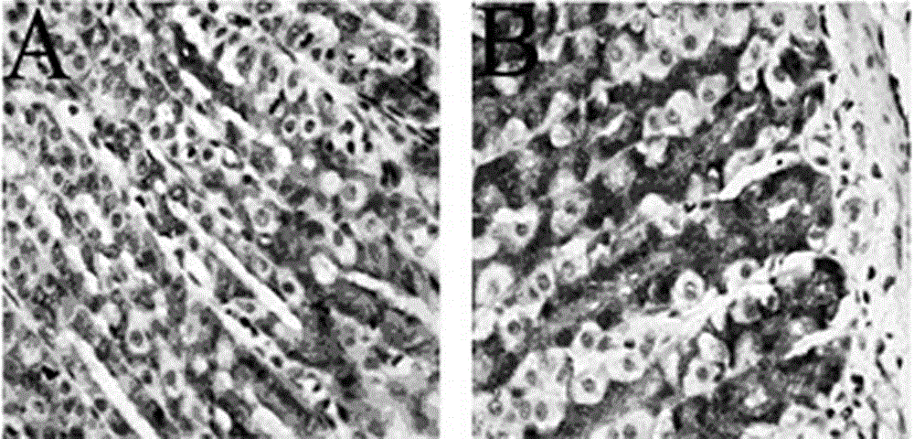 Manufacturing method of liver depression type gastric ulcer disease combined animal model