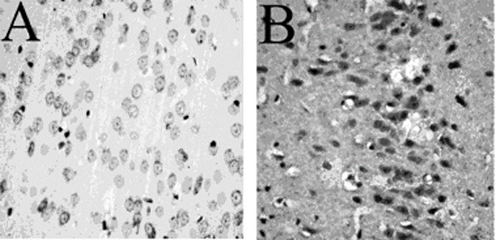 Manufacturing method of liver depression type gastric ulcer disease combined animal model