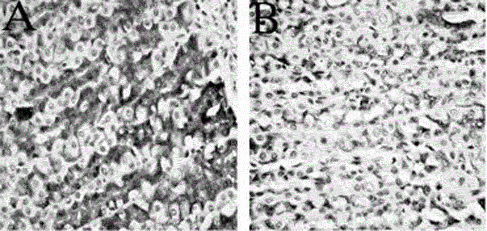 Manufacturing method of liver depression type gastric ulcer disease combined animal model