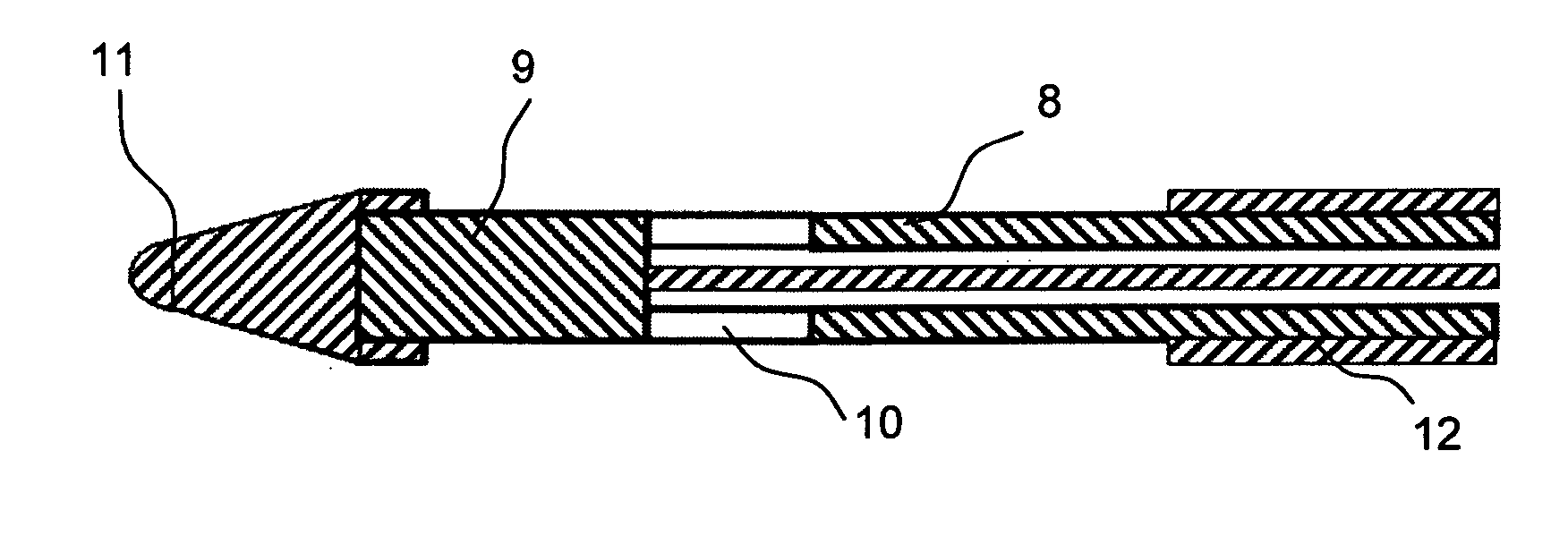 Method for treatment of hypertrophic palatine tonsils