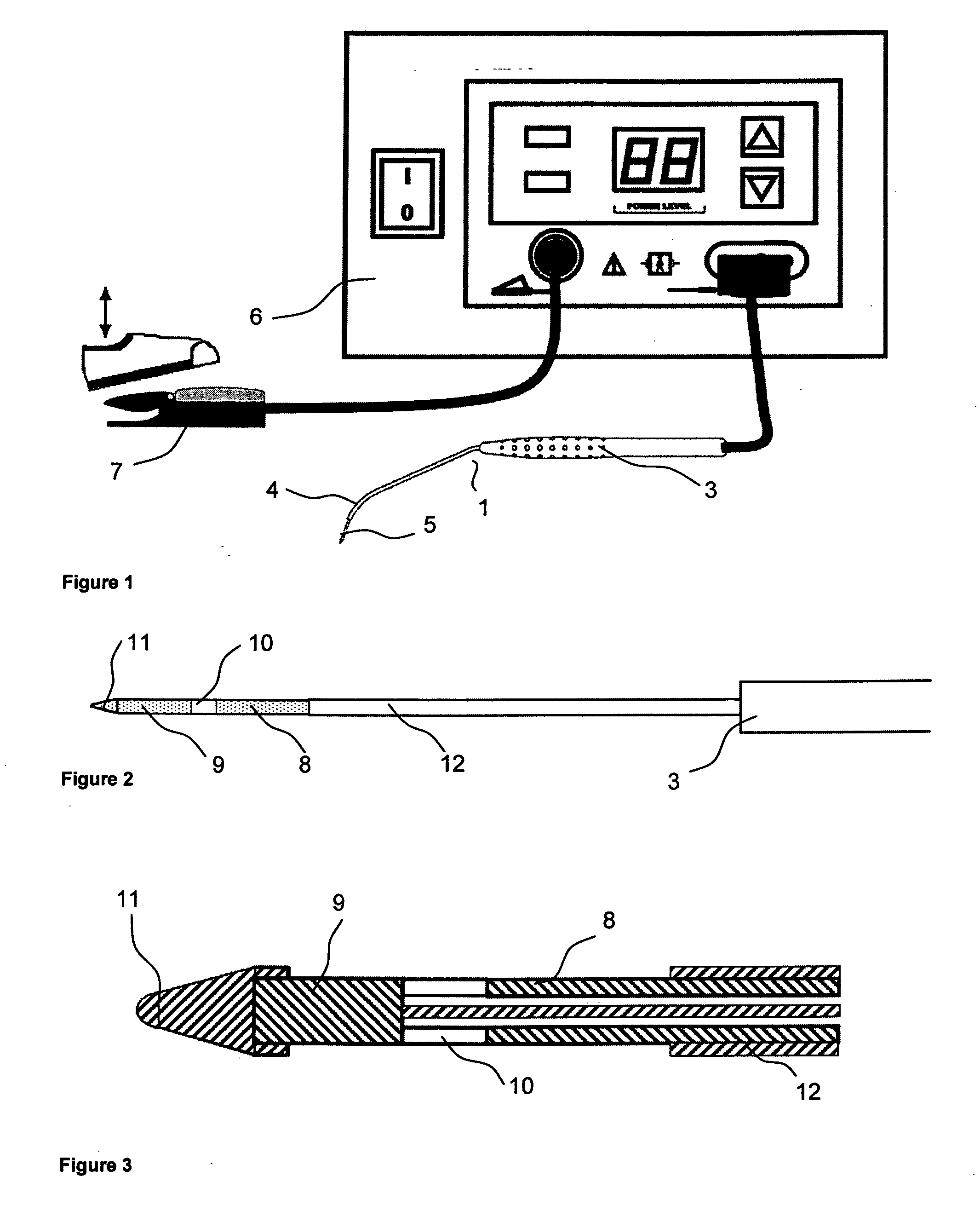 Method for treatment of hypertrophic palatine tonsils