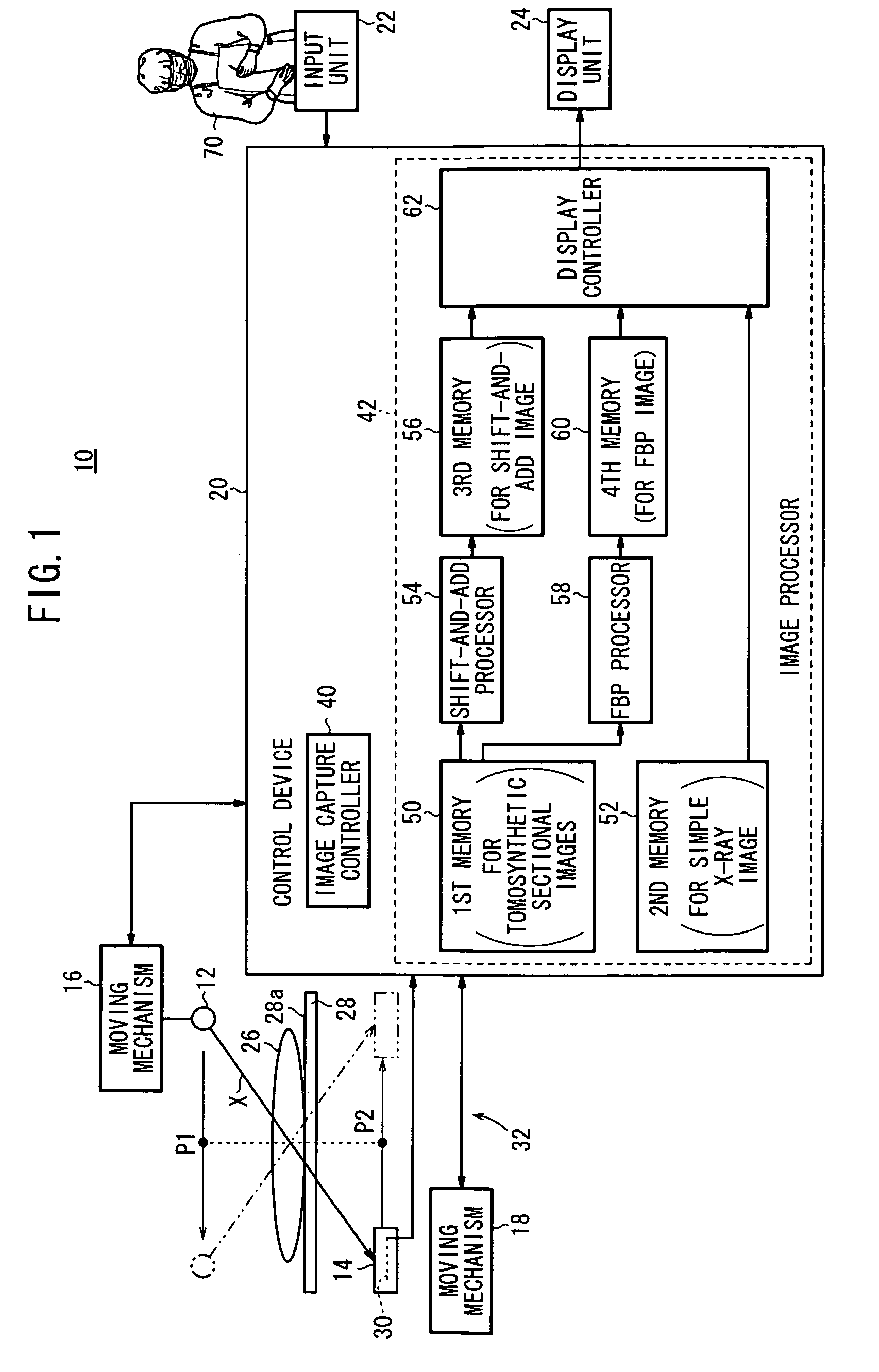 Radiation image diagnosing system