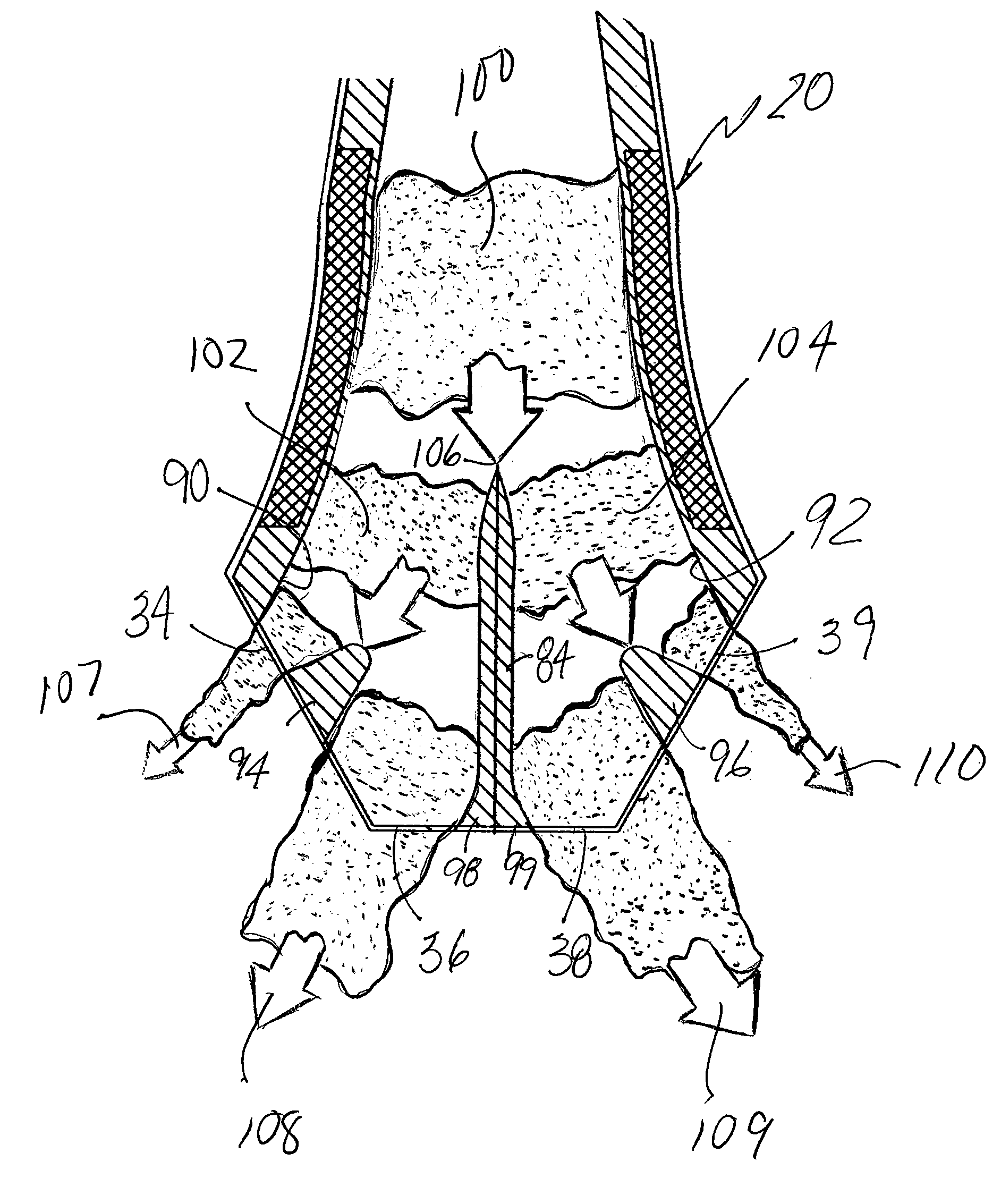 Submerged entry nozzle