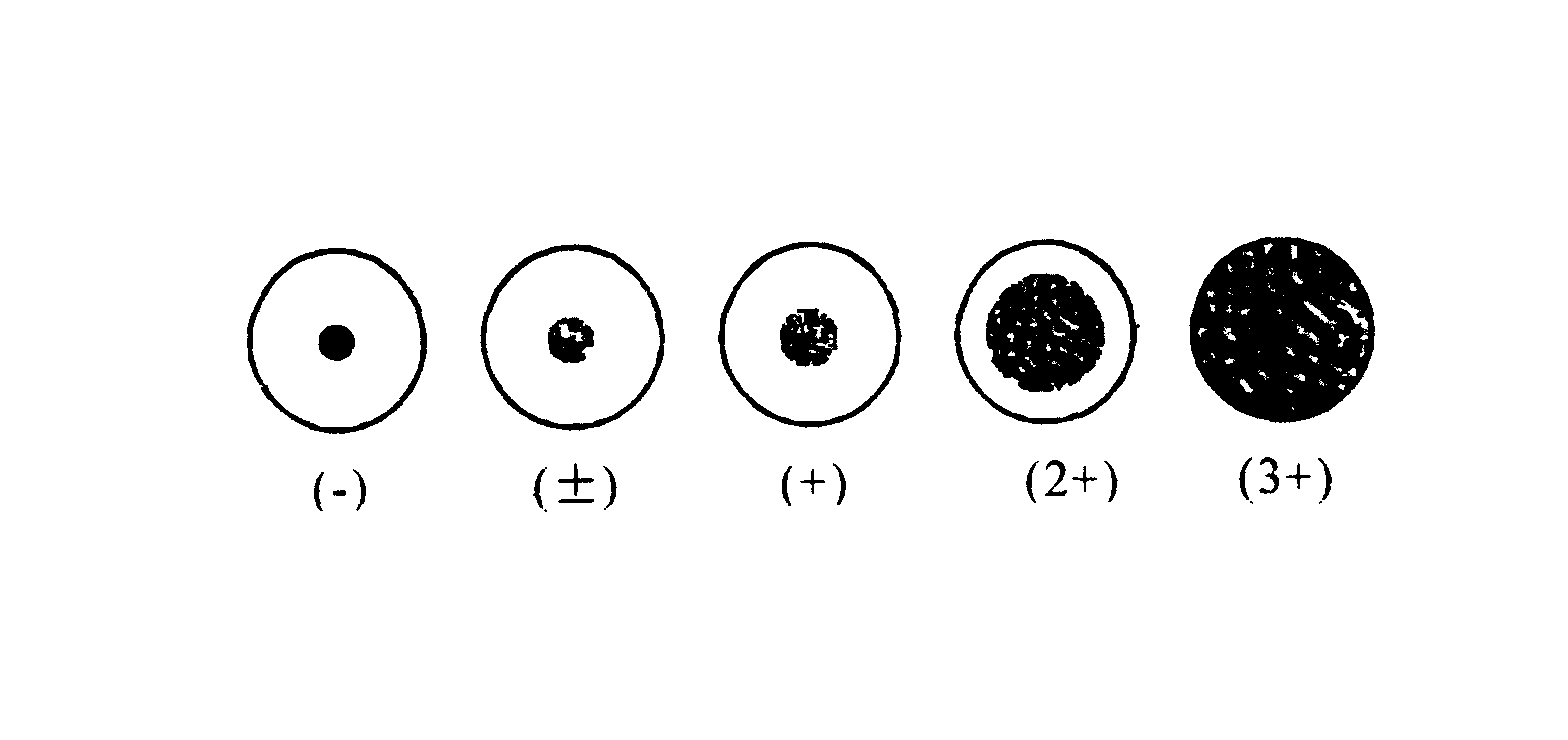 Preparing and assaying method of staphylococcus aureus filtrate preparation