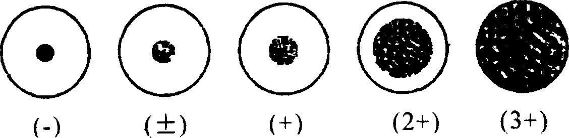 Preparing and assaying method of staphylococcus aureus filtrate preparation