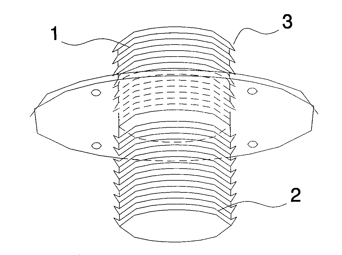 Prosthesis for anastomosis