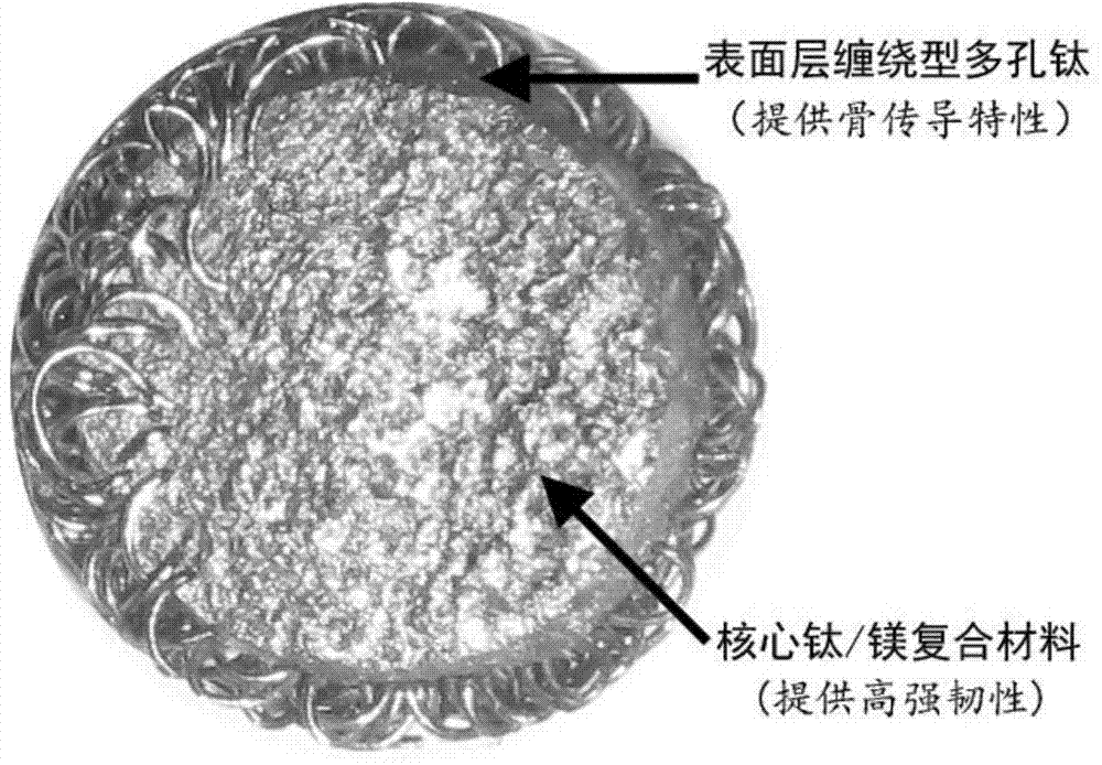 Medical semi-degraded titanium-magnesium composite microsphere bone filling material