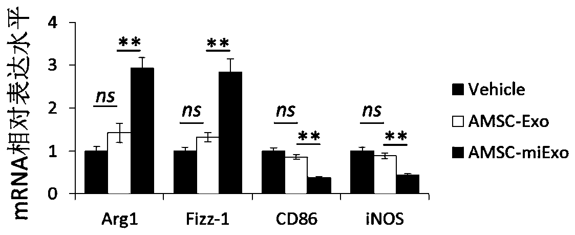 Preparation method and application of adipose-derived mesenchymal stem cell exosome